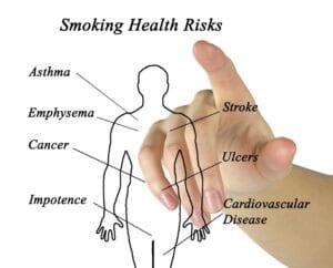 Stop Smoking Hypnosis | Health Issues | Alan Gilchrist Hypnotherapy